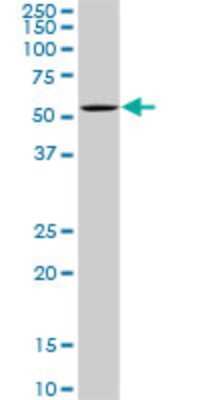 Western Blot: OXSR1 Antibody (3A8) [H00009943-M16]