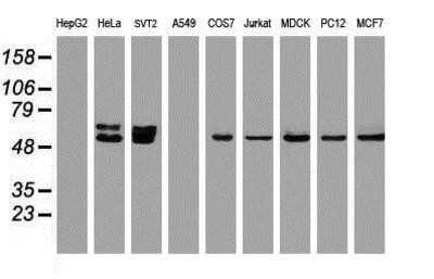 Western Blot: OXSR1 Antibody (OTI1F3)Azide and BSA Free [NBP2-73177]