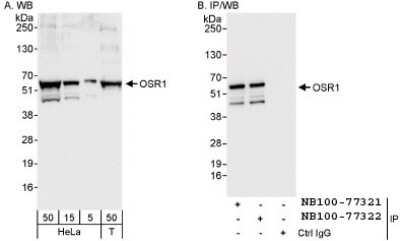 Western Blot: OXSR1 Antibody [NB100-77322]