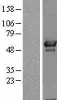 Western Blot: OXSR1 Overexpression Lysate [NBL1-14025]