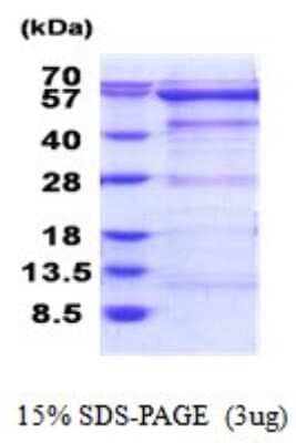 SDS-PAGE: Recombinant Human OXSR1 His Protein [NBP2-51859]