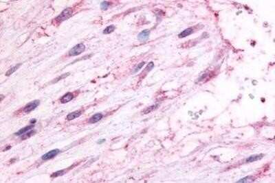 Immunohistochemistry-Paraffin: OXTR Antibody - BSA Free [NBP1-02334]