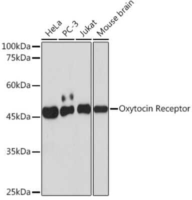 Western Blot: OXTR Antibody (7X8B8) [NBP3-15887]