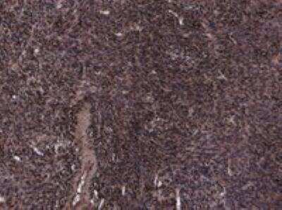 Immunohistochemistry-Paraffin: OXTR Antibody [NBP2-76347]