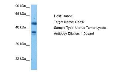 Western Blot: OXTR Antibody [NBP2-82300]