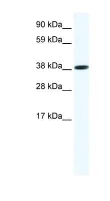 Western Blot: Obox6 Antibody [NBP1-91619]