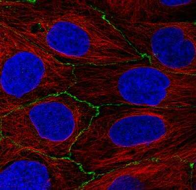 Immunocytochemistry/ Immunofluorescence: Occludin Antibody (CL1555) [NBP2-52971]