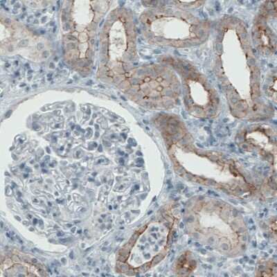 Immunohistochemistry-Paraffin: Occludin Antibody (CL1555) [NBP2-52971]