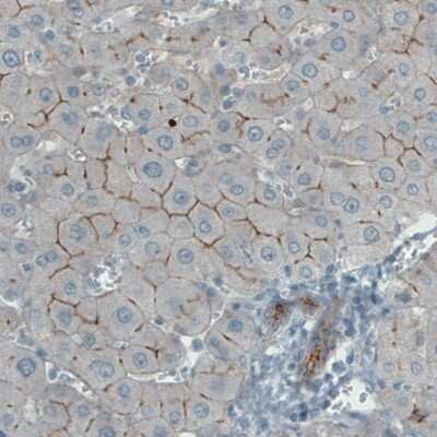 Immunohistochemistry-Paraffin: Occludin Antibody (CL1555) [NBP2-52971]