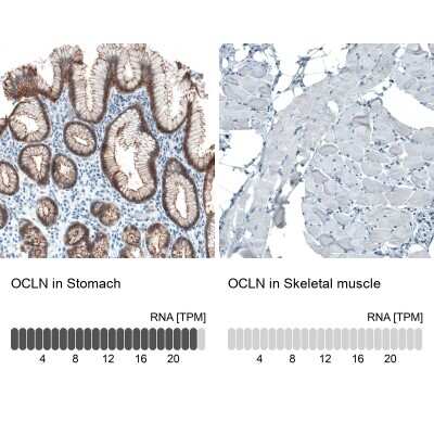 Immunohistochemistry-Paraffin: Occludin Antibody (CL1555) [NBP2-52971]