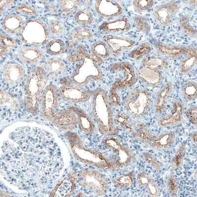 Immunohistochemistry-Paraffin: Occludin Antibody (CL1555) [NBP2-52971]