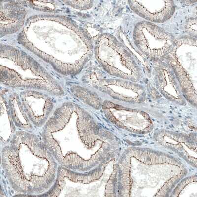 Immunohistochemistry-Paraffin: Occludin Antibody (CL1555) [NBP2-52971]