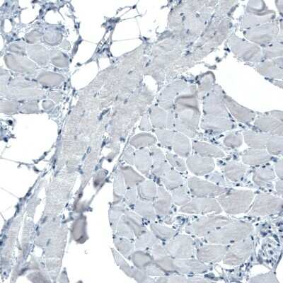 Immunohistochemistry-Paraffin: Occludin Antibody (CL1555) [NBP2-52971]