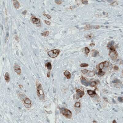 Immunohistochemistry-Paraffin: Occludin Antibody (CL1567) [NBP2-52972]