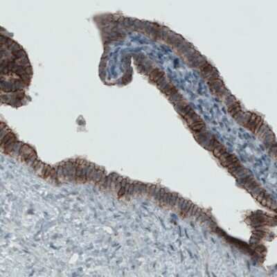 Immunohistochemistry-Paraffin: Occludin Antibody (CL1567) [NBP2-52972]