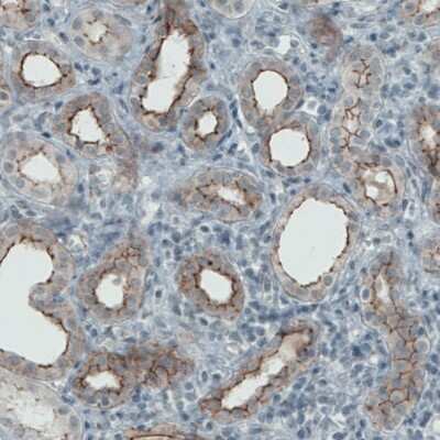 Immunohistochemistry-Paraffin: Occludin Antibody (CL1567) [NBP2-52972]