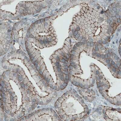 Immunohistochemistry-Paraffin: Occludin Antibody (CL1567) [NBP2-52972]