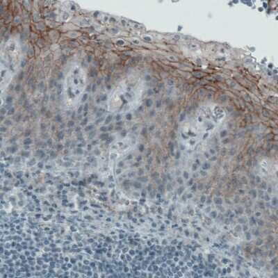 Immunohistochemistry-Paraffin: Occludin Antibody (CL1567) [NBP2-52972]