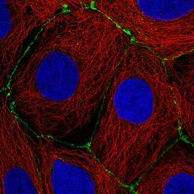Immunocytochemistry/ Immunofluorescence: Occludin Antibody (CL1608) [NBP2-52973]