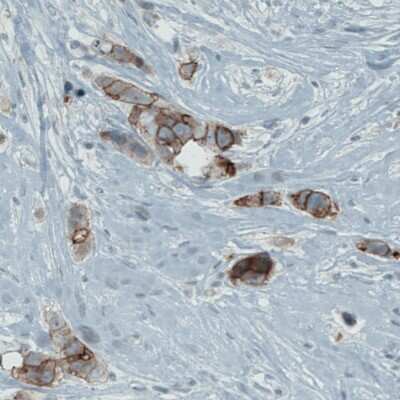 Immunohistochemistry-Paraffin: Occludin Antibody (CL1608) [NBP2-52973]