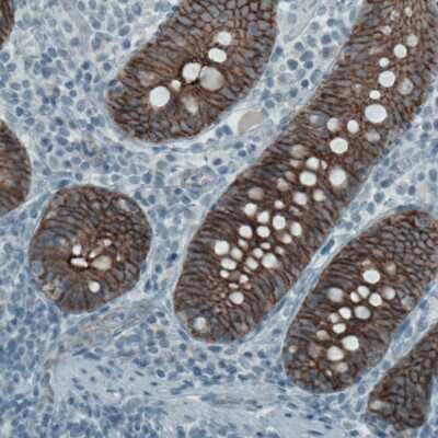 Immunohistochemistry-Paraffin: Occludin Antibody (CL1608) [NBP2-52973]