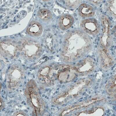 Immunohistochemistry-Paraffin: Occludin Antibody (CL1608) [NBP2-52973]