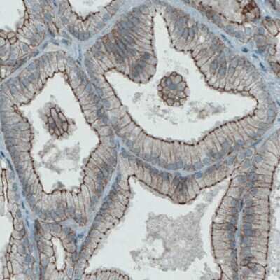 Immunohistochemistry-Paraffin: Occludin Antibody (CL1608) [NBP2-52973]