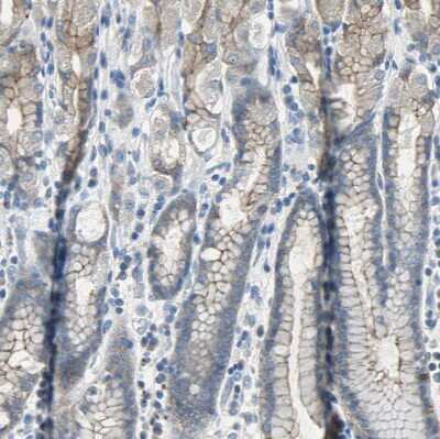 Immunohistochemistry-Paraffin: Occludin Antibody [NBP1-87402]