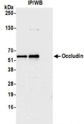 Immunoprecipitation: Occludin Antibody (BLR126H) [NBP3-14709]