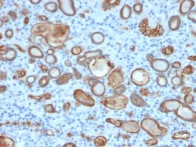 Immunohistochemistry-Paraffin: Occludin Antibody (OCLN/2181) - Azide and BSA Free [NBP3-08879]