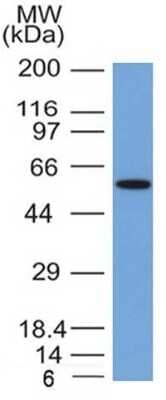 Western Blot: Occludin Antibody (OCLN/2181) [NBP3-07137]