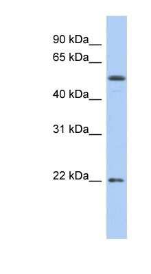 Western Blot: Occludin Antibody [NBP1-59435]