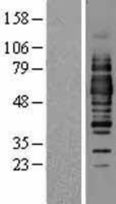 Western Blot: Occludin Overexpression Lysate [NBL1-13904]