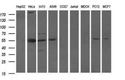 Western Blot: Oct-4B Antibody (OTI7H1)Azide and BSA Free [NBP2-73141]