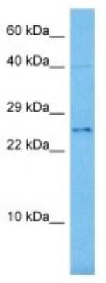 Western Blot: Octapeptide-repeat protein T2 Antibody [NBP3-10147]