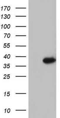 Western Blot: Ocular development associated gene Antibody (OTI1H1) [NBP2-45828]