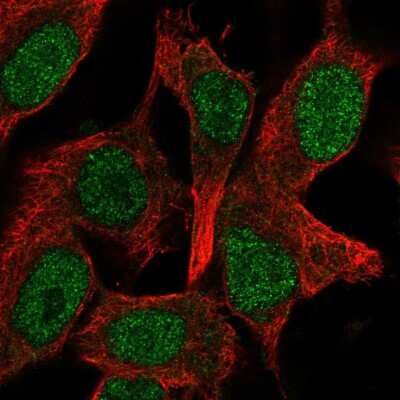 Immunocytochemistry/ Immunofluorescence: Ocular development associated gene Antibody [NBP2-57351]