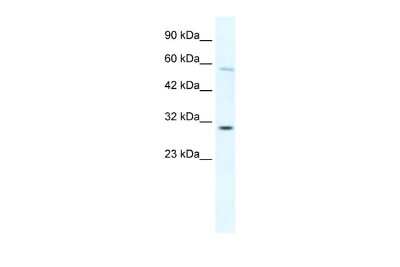 Western Blot: Ocular development associated gene Antibody [NBP2-87979]