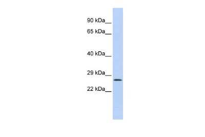 Western Blot: Ocular development associated gene Antibody [NBP2-87980]