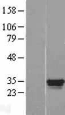 Western Blot: Ocular development associated gene Overexpression Lysate [NBL1-10985]