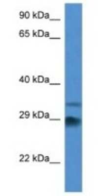 Western Blot: Odf1 Antibody [NBP1-74164]