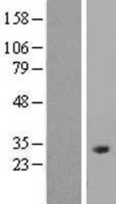 Western Blot: Odf1 Overexpression Lysate [NBP2-06332]