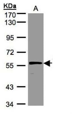 Western Blot: Olfactomedin-1/Noelin-1 Antibody [NBP1-31163]