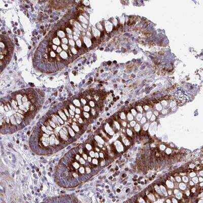 Immunohistochemistry-Paraffin: Olfactomedin-2/Noelin-2 Antibody [NBP2-31692]