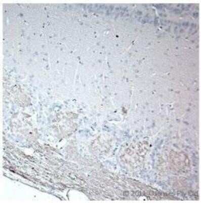 Immunohistochemistry-Paraffin: Olfactory Marker Protein Antibody - Azide and BSA Free [NB110-74753]