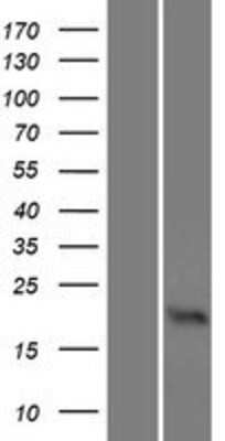 Western Blot: Olfactory Marker Protein Overexpression Lysate [NBP2-10426]