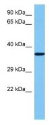 Western Blot: Olfactory Receptor 10 Antibody [NBP3-10244]