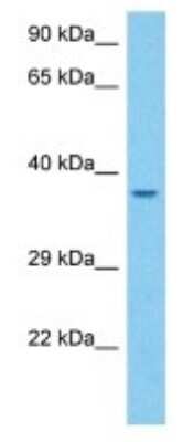 Western Blot: Olfactory Receptor 5 Antibody [NBP3-10267]