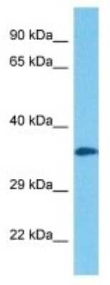 Western Blot: Olfactory Receptor 8 Antibody [NBP3-10254]