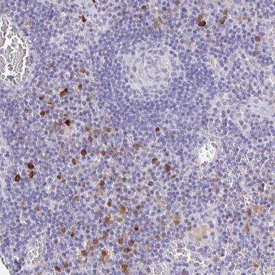 Immunohistochemistry-Paraffin: Olfactory Receptor OR2A4 Antibody [NBP2-46848]